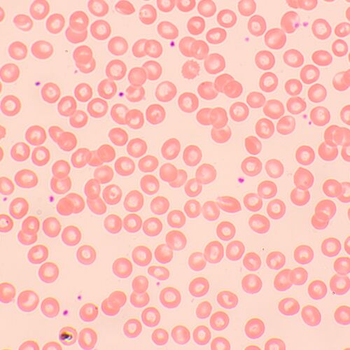 Микроскоп биологический MAGUS Bio 250BL, фото , изображение 18